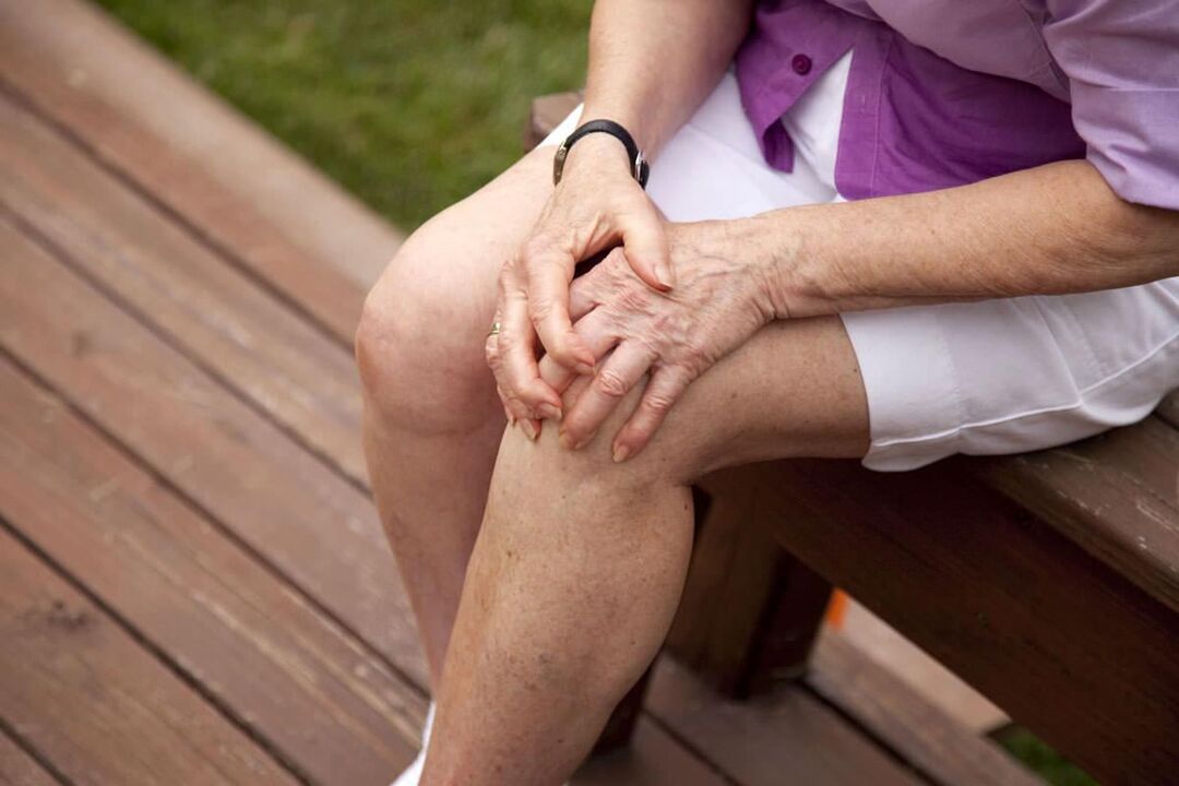 Osteoartritis kolena je pogost pri starejših ženskah