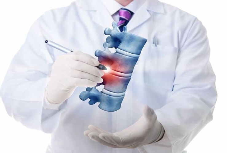 poškodbe hrbtenice zaradi torakalne osteohondroze